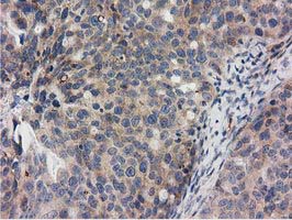 m06806 anti rasd2 mouse monoclonal antibody clone id oti1g1 ihc testing 4