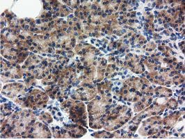 m06806 anti rasd2 mouse monoclonal antibody clone id oti1g1 ihc testing 5