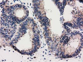 m06806 anti rasd2 mouse monoclonal antibody clone id oti1g1 ihc testing 6
