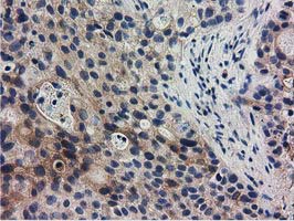 m06806 anti rasd2 mouse monoclonal antibody clone id oti1g1 ihc testing 7