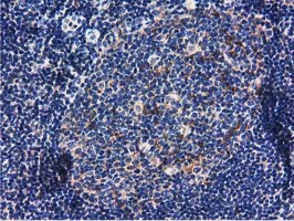 m06806 anti rasd2 mouse monoclonal antibody clone id oti1g1 ihc testing 8