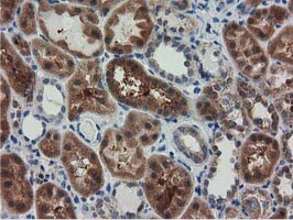 m06806 anti rasd2 mouse monoclonal antibody clone id oti1g1 ihc testing 9