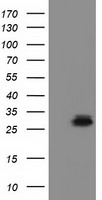 HEK293T cells were transfected with the pCMV6-ENTRY control (Left lane) or pCMV6-ENTRY RASD2 (Right lane) cDNA for 48 hrs and lysed
