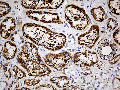 m06812 anti aldh4a1 mouse monoclonal antibody clone id oti1h10 ihc testing 3