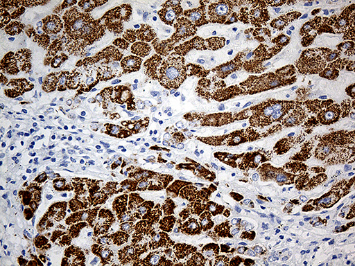 m06812 anti aldh4a1 mouse monoclonal antibody clone id oti1h10 ihc testing 4