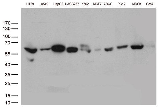m06812 anti aldh4a1 mouse monoclonal antibody clone id oti1h10 wb testing 2