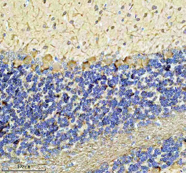 m06821 nefm primary antibodies ihc testing 1