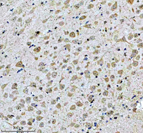 m06821 nefm primary antibodies ihc testing 2