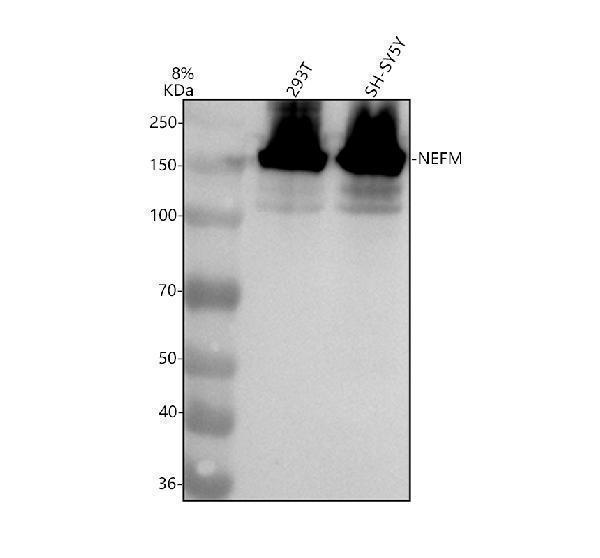 m06821 nefm primary antibodies wb testing 1