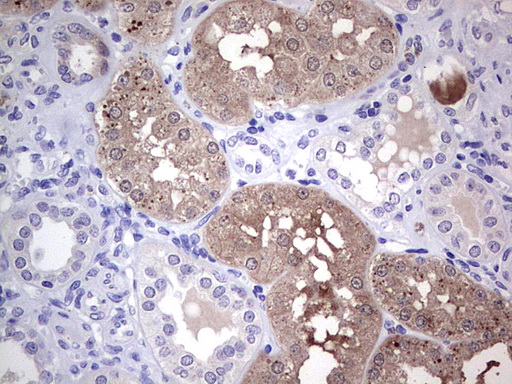 m06825 1 anti mad2l1 binding protein mad2l1bp mouse monoclonal antibody clone id oti3c11 ihc testing 2