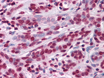 m06831 zbtb7b primary antibodyes ihc testing 2