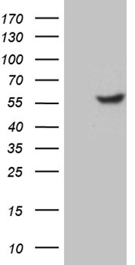 HEK293T cells were transfected with the pCMV6-ENTRY control (Left lane) or pCMV6-ENTRY TFDP2 (Right lane) cDNA for 48 hrs and lysed