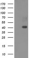 HEK293T cells were transfected with the pCMV6-ENTRY control (Left lane) or pCMV6-ENTRY MAPRE2 (Right lane) cDNA for 48 hrs and lysed