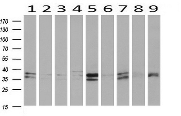 Western blot analysis of extracts (10ug) from 9 Human tissue by using anti-MAPRE2 monoclonal antibody at 1:200 (1: Testis; 2: Omentum; 3: Uterus; 4: Breast; 5: Brain; 6: Liver; 7: Ovary; 8: Thyroid gland; 9: colon)