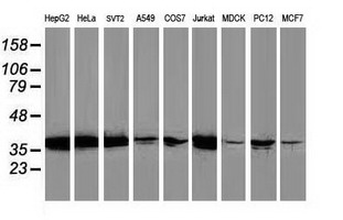Western blot analysis of extracts (35ug) from 9 different cell lines by using anti-MAPRE2 monoclonal antibody