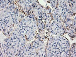 m06859 anti eb2 mapre2 mouse monoclonal antibody clone id oti7a2 ihc testing 10