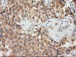 m06859 anti eb2 mapre2 mouse monoclonal antibody clone id oti7a2 ihc testing 2