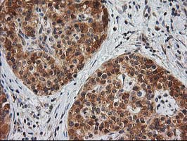 m06859 anti eb2 mapre2 mouse monoclonal antibody clone id oti7a2 ihc testing 4