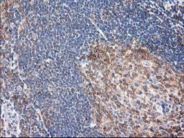 m06859 anti eb2 mapre2 mouse monoclonal antibody clone id oti7a2 ihc testing 5