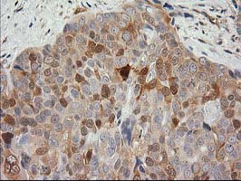 m06859 anti eb2 mapre2 mouse monoclonal antibody clone id oti7a2 ihc testing 7
