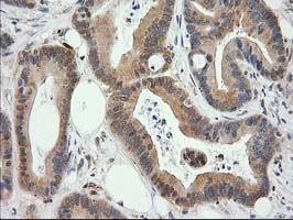 m06859 anti eb2 mapre2 mouse monoclonal antibody clone id oti7a2 ihc testing 8
