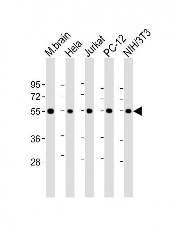 All lanes : Anti-beta II Tubulin at 1:8000 dilutionLane 1: mouse brain lysateLane 2: Hela whole cell lysateLane 3: Jurkat whole cell lysateLane 4: PC-12 whole cell lysateLane 5: NIH/3T3 whole cell lysateLysates/proteins at 20 µg per lane