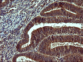 m06868 2 anti beta ii tubulin tubb2a mouse monoclonal antibody clone id oti3e6 ihc testing 2
