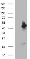 m06868 2 anti beta ii tubulin tubb2a mouse monoclonal antibody clone id oti3e6 wb testing 1