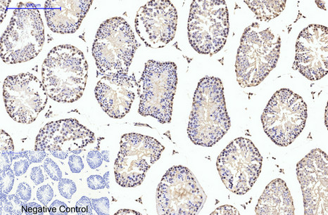 m06868 tubb2a primary antibodies ihc testing 1