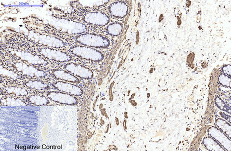 Immunohistochemical analysis of paraffin-embedded Human-colon tissue