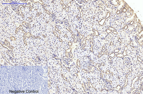 m06868 tubb2a primary antibodies ihc testing 5