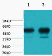 Western blot analysis of 1) Mouse Brain tissue, 2) Rat Brain tissue, diluted at 1:100000
