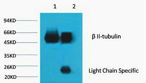 1) Input: Mouse Brain Tissue Lysate 2) IP product: IP dilute 1: 200 Western blot analysis: primary antibody : TDY191 1: 10000 Secondary antibody: Goat anti-Mouse IgG, Light chain specific (S003), 1: 5000