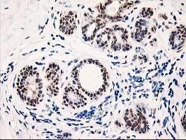 m06870 anti pig3 tp53i3 mouse monoclonal antibody clone id oti3b11 ihc testing 4