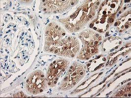 m06870 anti pig3 tp53i3 mouse monoclonal antibody clone id oti3b11 ihc testing 5