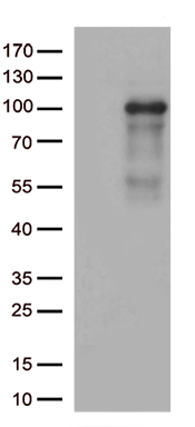 HEK293T cells were transfected with the pCMV6-ENTRY control (Left lane) or pCMV6-ENTRY ADAM28 (Right lane) cDNA for 48 hrs and lysed