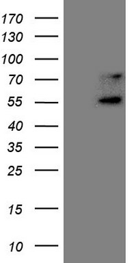 m06879 anti upstream binding protein 1 ubp1 mouse monoclonal antibody clone id oti6c7 wb testing 1