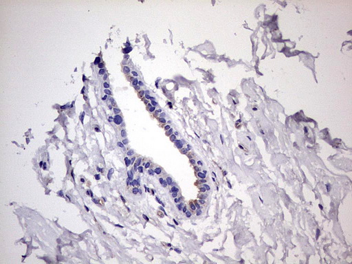 Immunohistochemical staining of paraffin-embedded Human breast tissue within the normal limits using anti-KYNU mouse monoclonal antibody