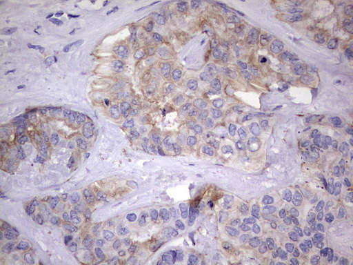 m06885 1 anti l kynurenine hydrolase kynu mouse monoclonal antibody clone id oti5e4 ihc testing 4
