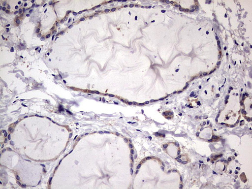 m06885 anti l kynurenine hydrolase kynu mouse monoclonal antibody clone id oti1h1 ihc testing 5