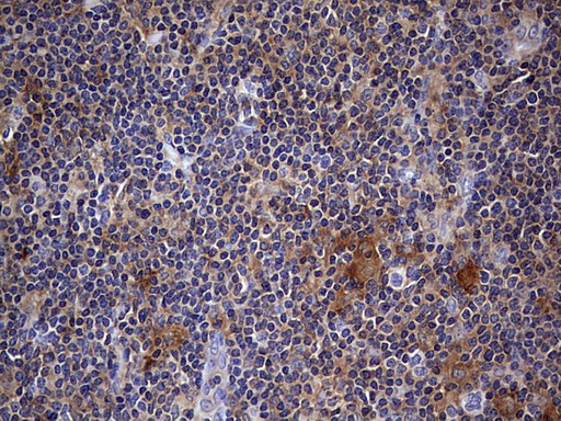 m06885 anti l kynurenine hydrolase kynu mouse monoclonal antibody clone id oti1h1 ihc testing 7