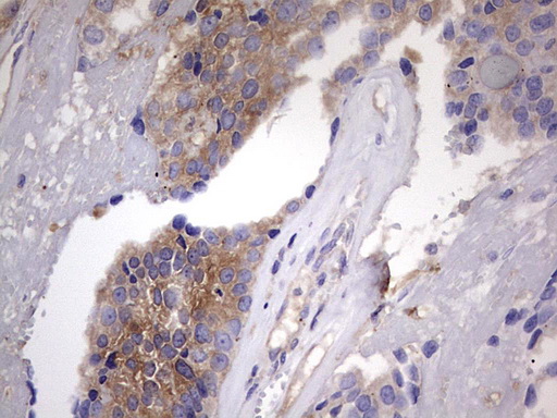 m06885 anti l kynurenine hydrolase kynu mouse monoclonal antibody clone id oti1h1 ihc testing 8