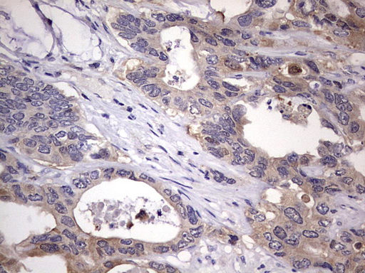 m06885 anti l kynurenine hydrolase kynu mouse monoclonal antibody clone id oti1h1 ihc testing 9