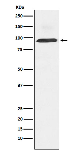 Western blot analysis of Dynamin 3 expression in Human fetal brain lysate