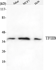Western blotting validation for Anti-TFIIB GTF2B Monoclonal Antibody M06893-1
Western Blot (WB) analysis using TFIIB Monoclonal Antibody against Jurkat