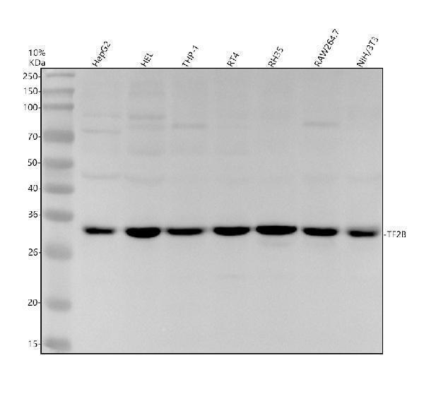 Western blot analysis of TF2B using anti-TF2B antibody (M06893-2)