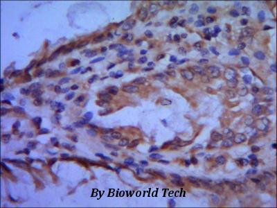 IHC of paraffin-embedded human colon using anti- TFIIB diluted 1/500-1/1000