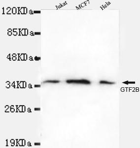Western blot detection of TFIIB in Jurkat, MCF7&Hela cell lysates using TFIIB antibody (1:1000 diluted) 