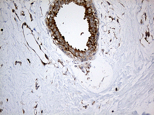 Immunohistochemical staining of paraffin-embedded Human breast tissue within the normal limits using anti-IL34 mouse monoclonal antibody
