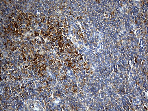 Immunohistochemical staining of paraffin-embedded Human tonsil within the normal limits using anti-IL34 mouse monoclonal antibody
